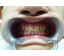 Dental Findıngs Associated with Hypoparathyroidism