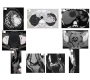 Valentine Day Special: “From Radiology with Love”