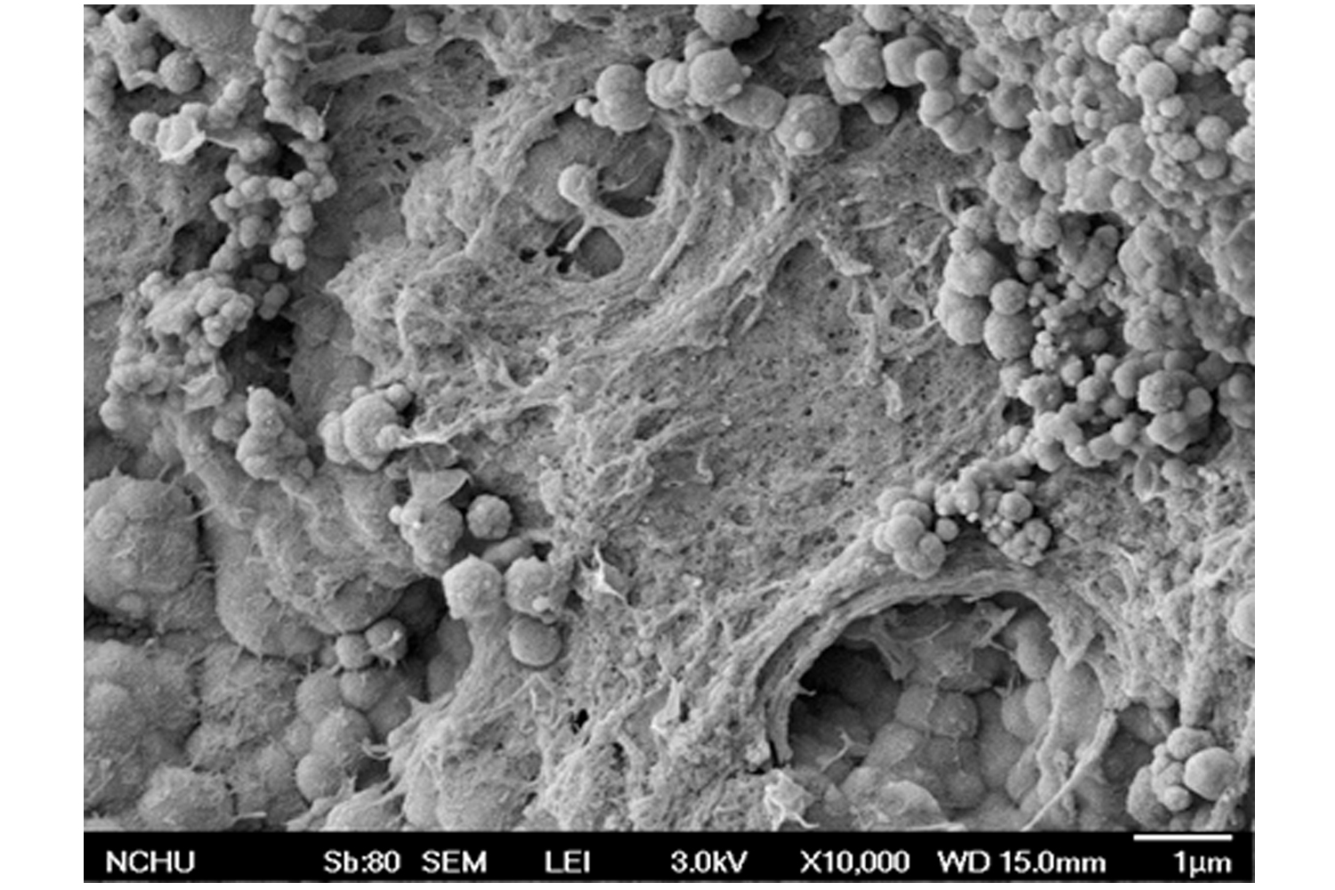 Dental Pulp Stem Cell Cultured on Calcium Silicate Cement