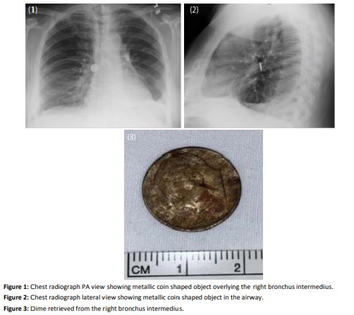 Treasure in the Airway