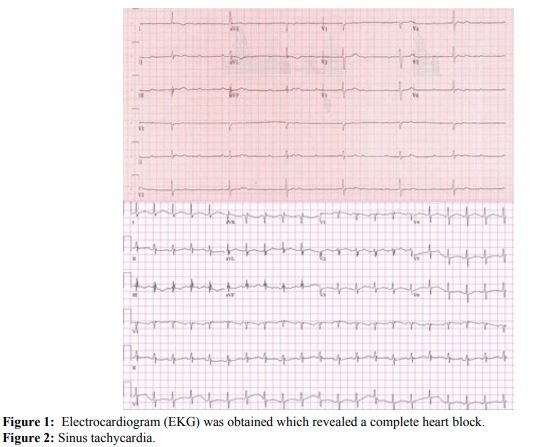 Heart Block in Severe Acidosis